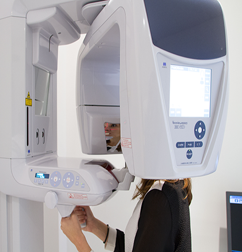 cone_bean1. Bartelpng